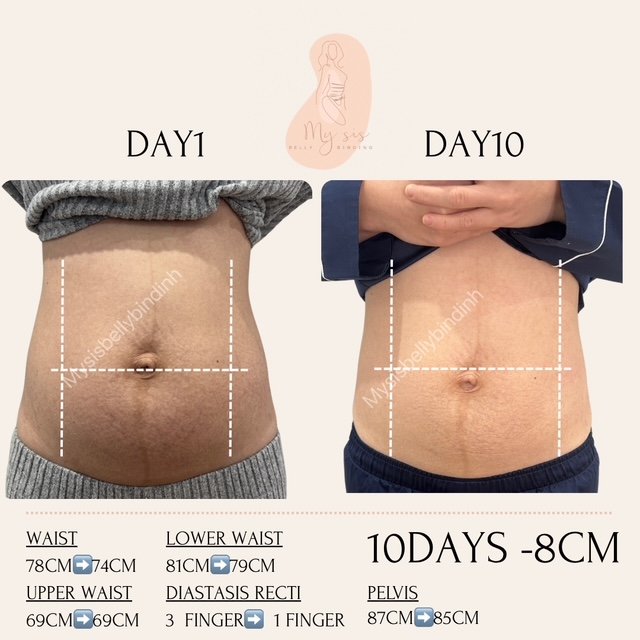 {"ARInfo":{"IsUseAR":false},"Version":"1.0.0","MakeupInfo":{"IsUseMakeup":false},"FaceliftInfo":{"IsChangeEyeLift":false,"IsChangeFacelift":false,"IsChangePostureLift":false,"IsChangeNose":false,"IsChangeFaceChin":false,"IsChangeMouth":false,"IsChangeThinFace":false},"BeautyInfo":{"SwitchMedicatedAcne":false,"IsAIBeauty":false,"IsBrightEyes":false,"IsSharpen":false,"IsOldBeauty":false,"IsReduceBlackEyes":false},"HandlerInfo":{"AppName":2},"FilterInfo":{"IsUseFilter":false}}