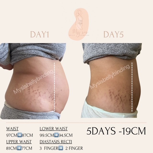 {"ARInfo":{"IsUseAR":false},"Version":"1.0.0","MakeupInfo":{"IsUseMakeup":false},"FaceliftInfo":{"IsChangeEyeLift":false,"IsChangeFacelift":false,"IsChangePostureLift":false,"IsChangeNose":false,"IsChangeFaceChin":false,"IsChangeMouth":false,"IsChangeThinFace":false},"BeautyInfo":{"SwitchMedicatedAcne":false,"IsAIBeauty":false,"IsBrightEyes":false,"IsSharpen":false,"IsOldBeauty":false,"IsReduceBlackEyes":false},"HandlerInfo":{"AppName":2},"FilterInfo":{"IsUseFilter":false}}