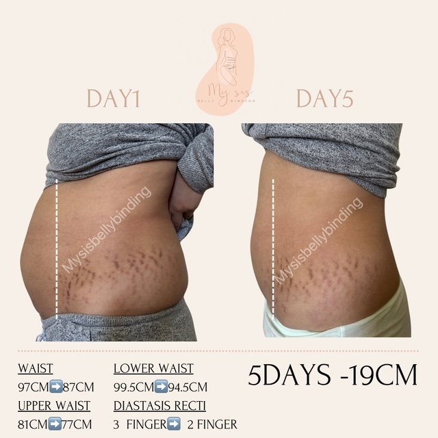 {"ARInfo":{"IsUseAR":false},"Version":"1.0.0","MakeupInfo":{"IsUseMakeup":false},"FaceliftInfo":{"IsChangeEyeLift":false,"IsChangeFacelift":false,"IsChangePostureLift":false,"IsChangeNose":false,"IsChangeFaceChin":false,"IsChangeMouth":false,"IsChangeThinFace":false},"BeautyInfo":{"SwitchMedicatedAcne":false,"IsAIBeauty":false,"IsBrightEyes":false,"IsSharpen":false,"IsOldBeauty":false,"IsReduceBlackEyes":false},"HandlerInfo":{"AppName":2},"FilterInfo":{"IsUseFilter":false}}