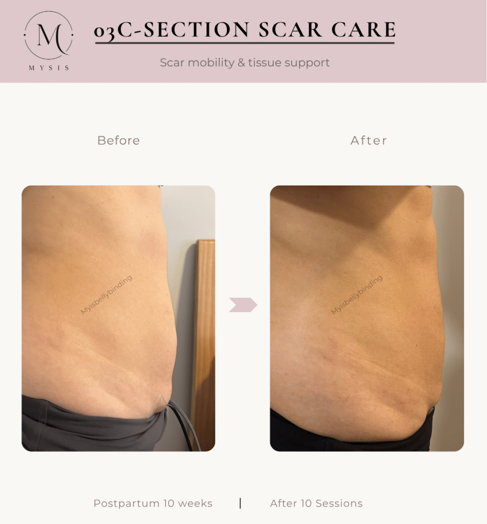 scar feel tight