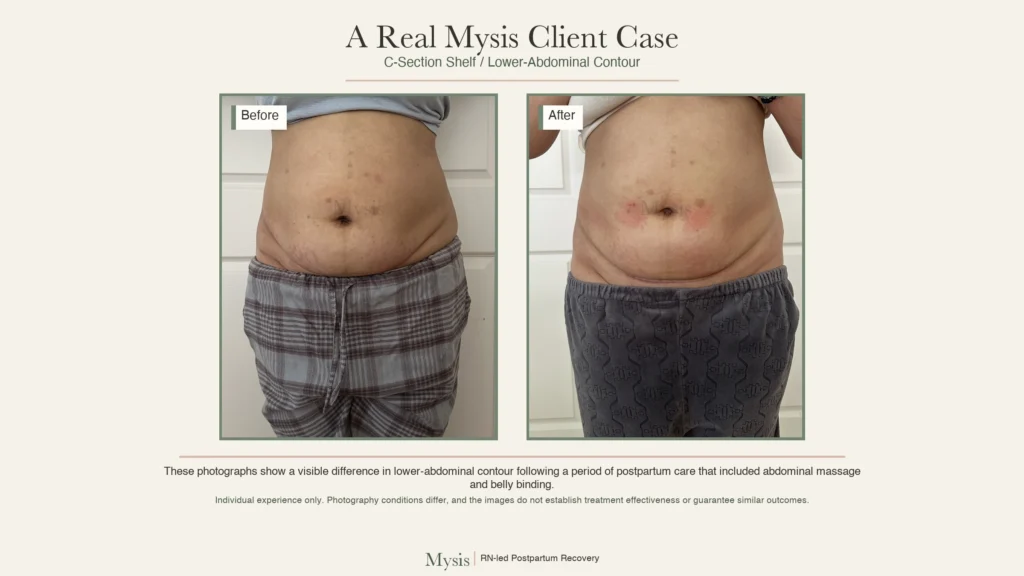 Side-by-side photographs of the same postpartum client before and after Mysis care, with differences in clothing, arm position and framing